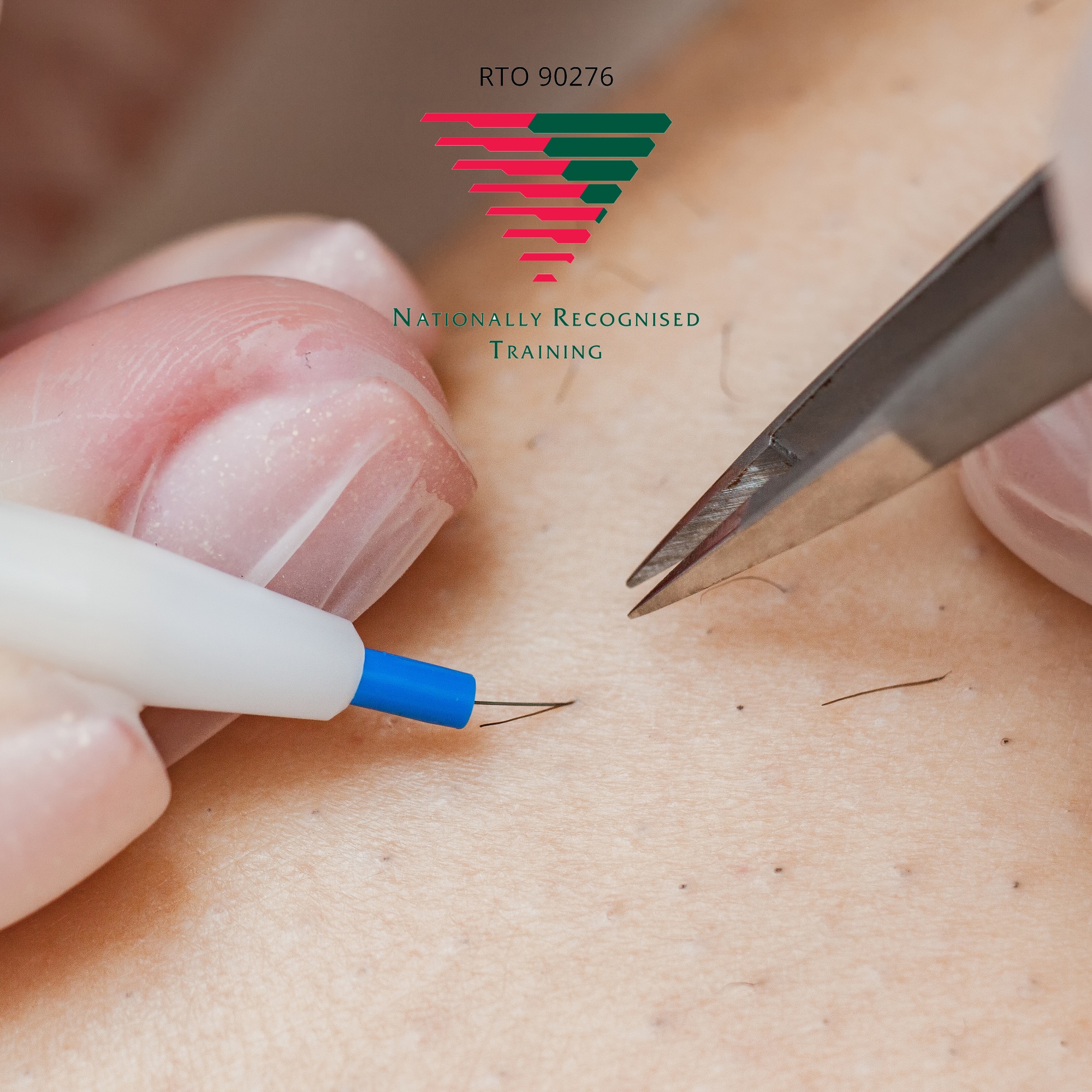 Electrolysis  Course- SHBBHRS013 - Provide Hair Reduction Treatments Using Electrical Currents